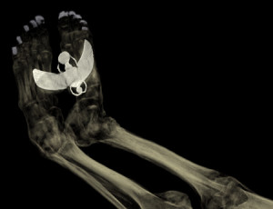 CT scan of the feet of Tayesmutengebtiu, also called Tamut, to show the metal covers on her toenails and the large amulet of the winged scarab beetle Khepri. © Trustees of the British Museum